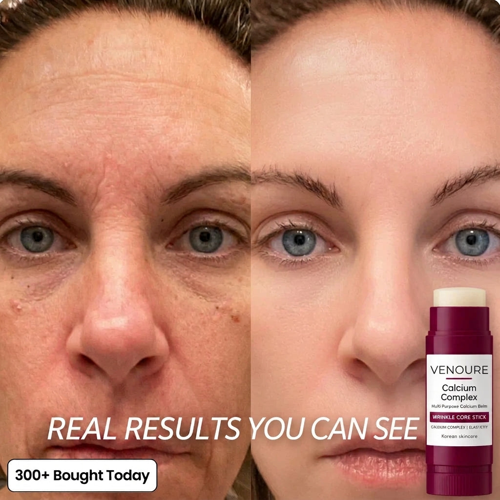 Venoure™ Korean Calcium Complex Balm