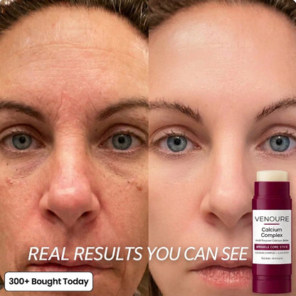 Venoure™ Korean Calcium Complex Balm