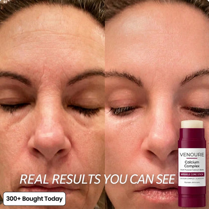 Venoure™ Korean Calcium Complex Balm